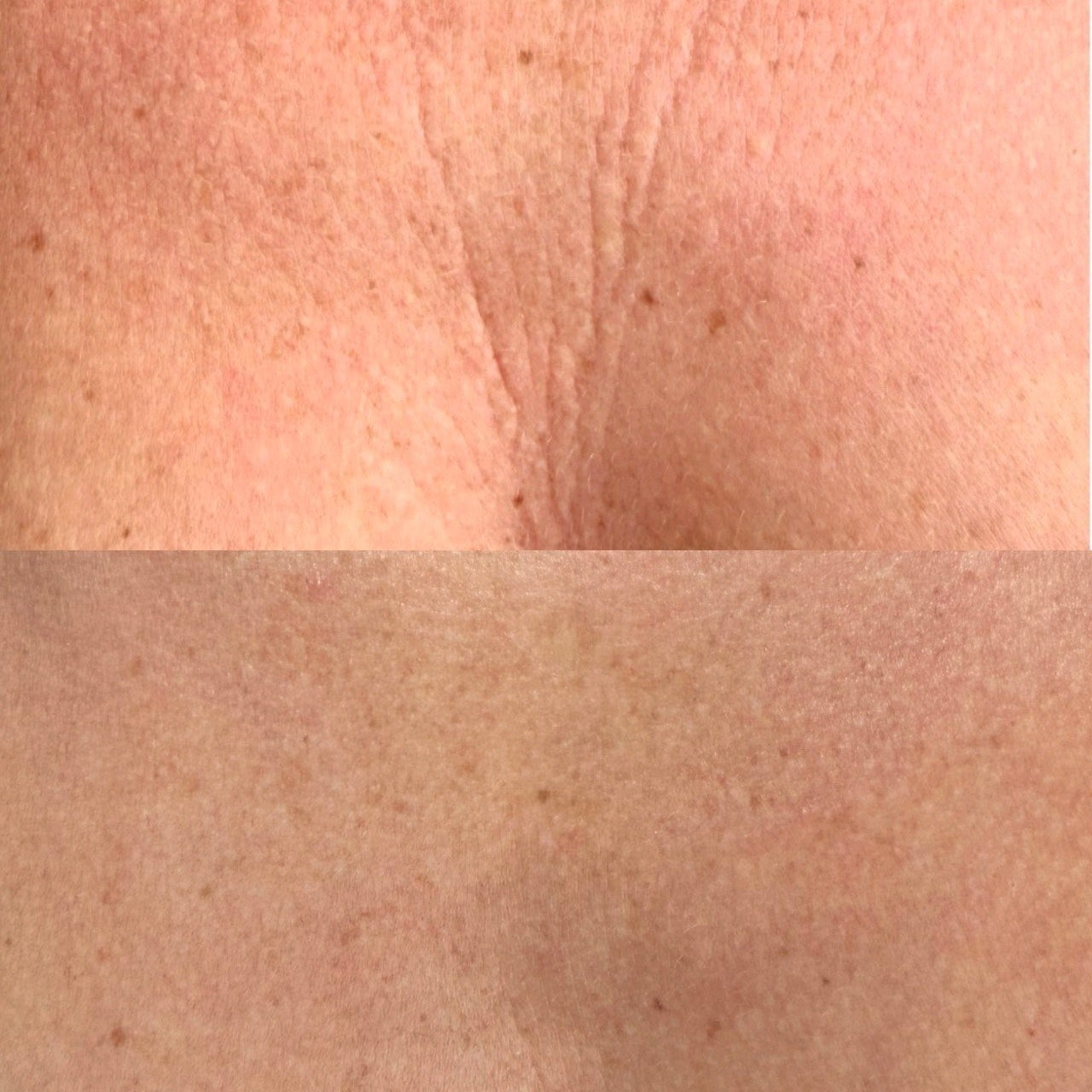 AnovàClair Advanced Full Coverage LED Mask
