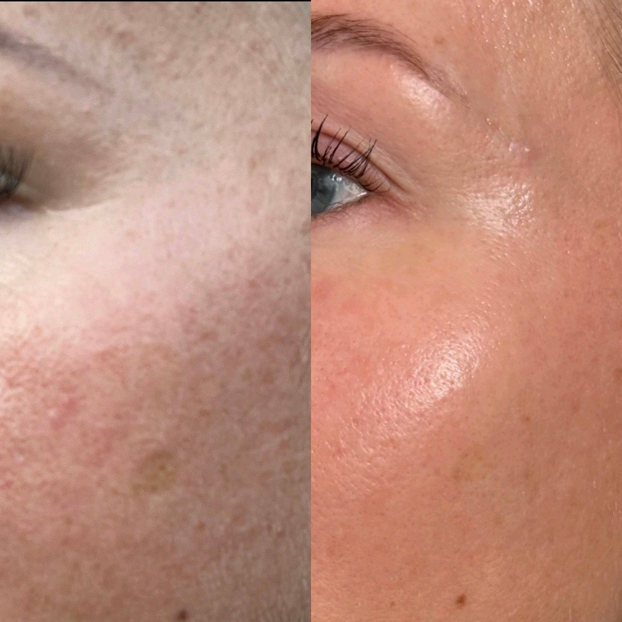 AnovàClair Advanced Full Coverage LED Mask